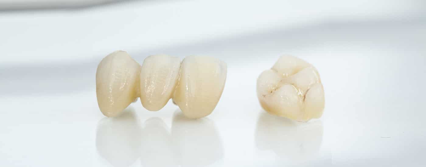 Dental Laboratory Supplies | Removable Dental Lab | LaboSmileUSA